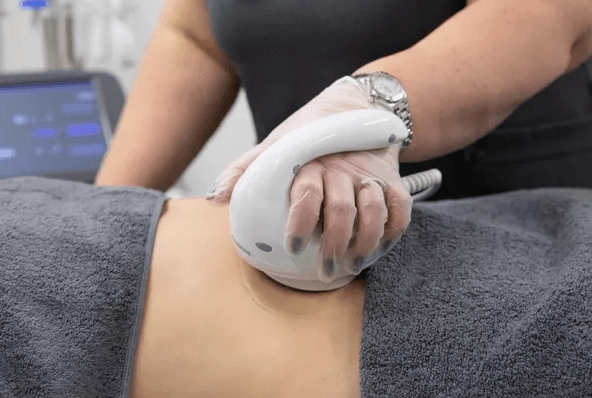 CAVITATION – INCH LOSS