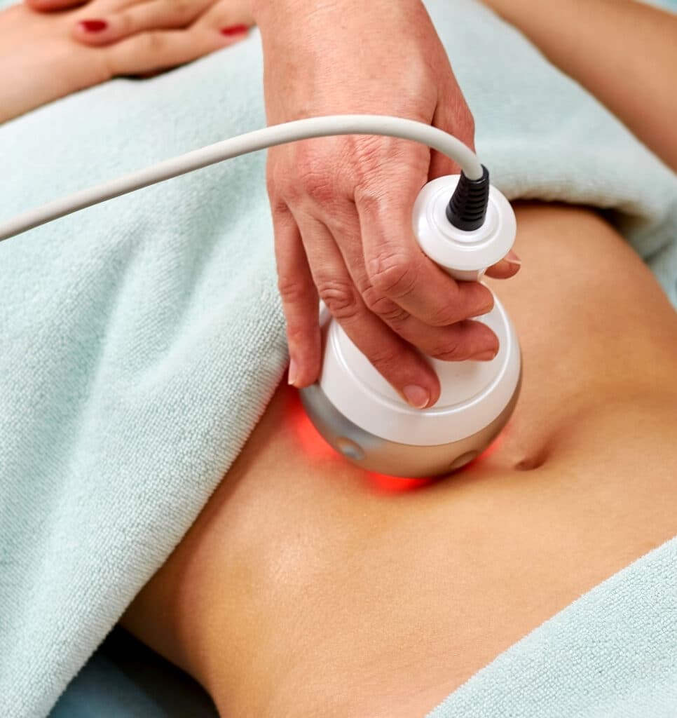 RADIO FREQUENCY – SKIN TIGHTENING
